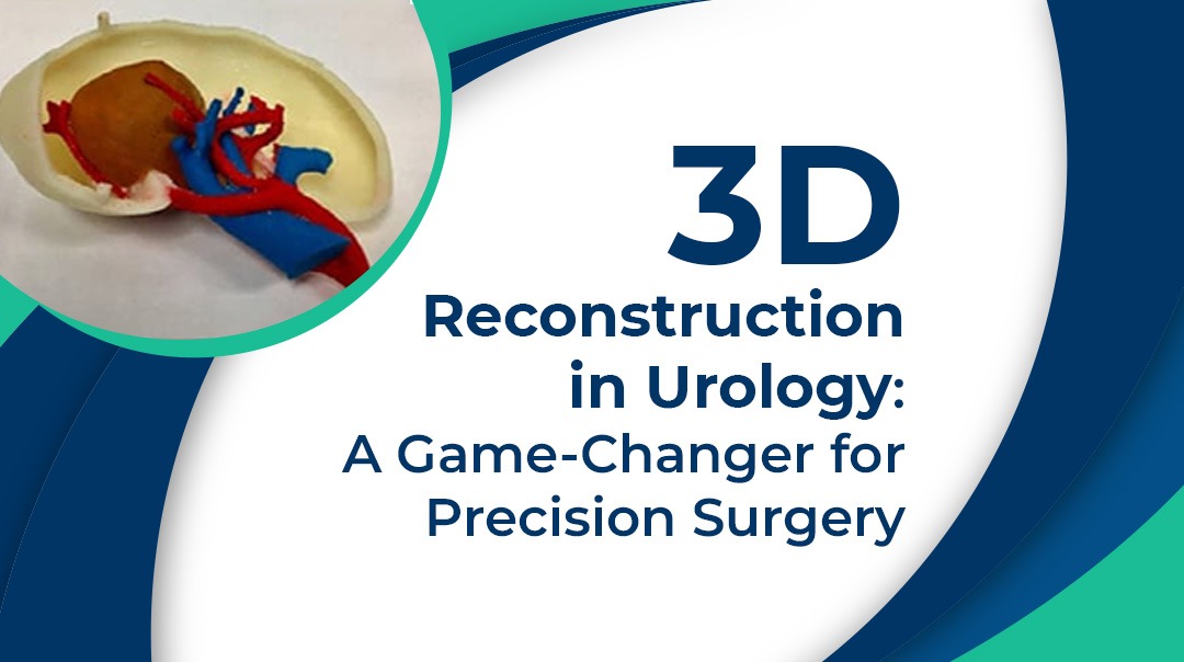 3D Reconstruction in Urology
