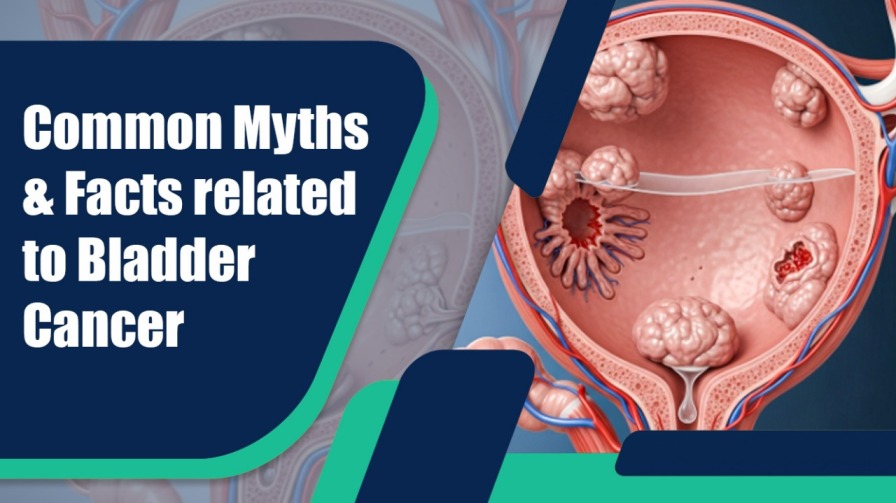 Common Myths & Facts related to Bladder Cancer