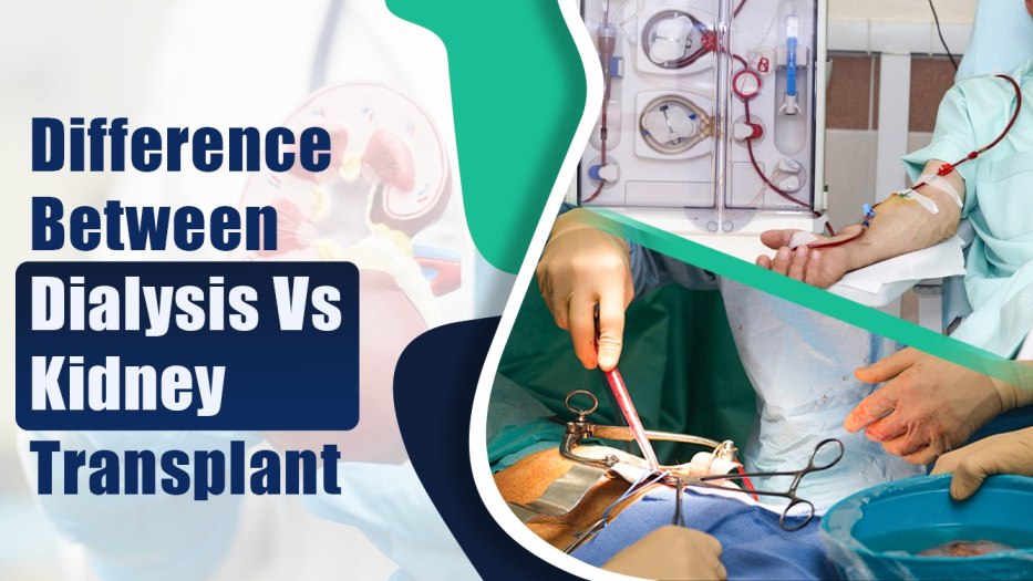 Dialysis Vs Kidney Transplant