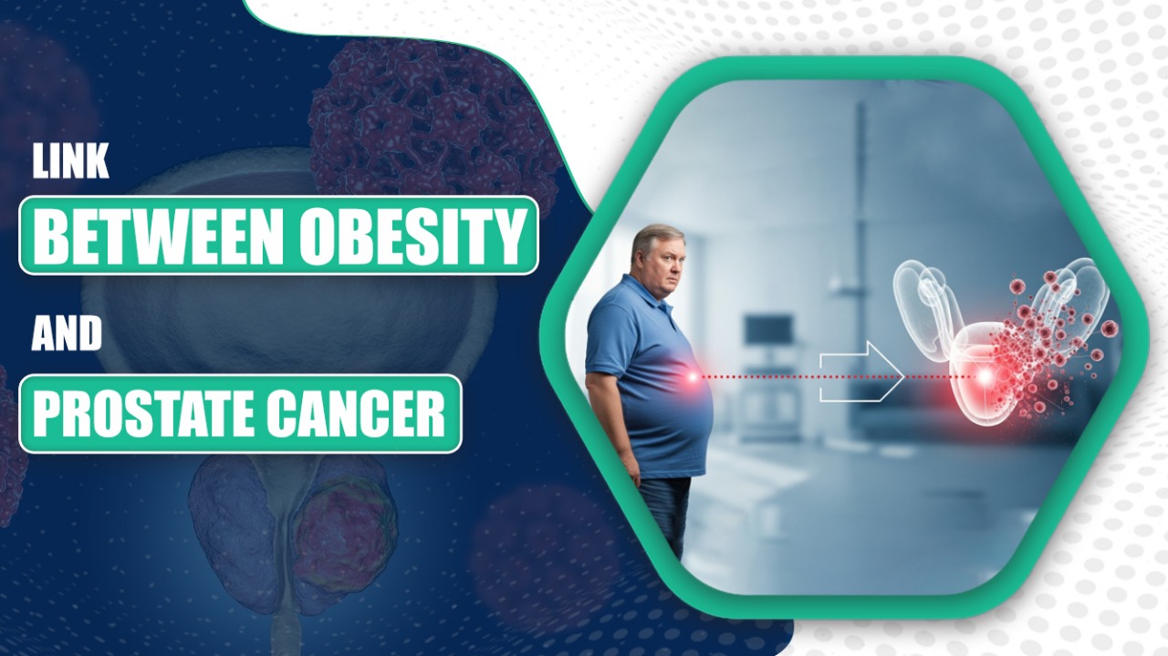 Link Between Obesity and Prostate Cancer